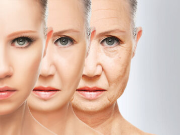 Rejuvenecimiento de la parte superior de la cara