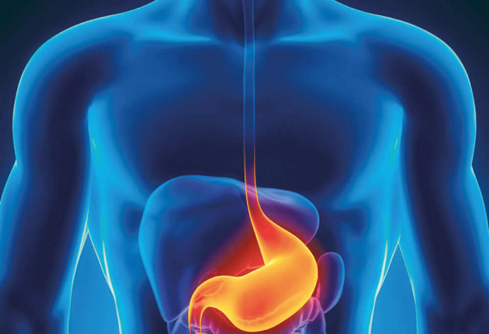 Hablando Sobre Acidez y Reflujo