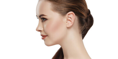 RINOPLASTIA DE REVISIÓN